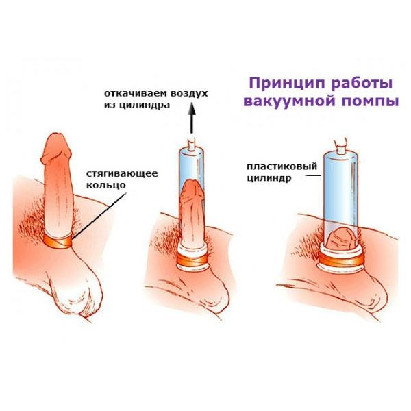 Тікелей әйелдің арбауы бейне